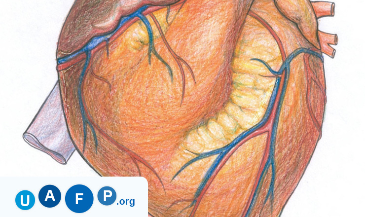 Atrial Fibrillation