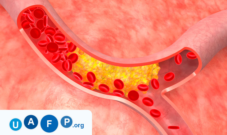 Vascular Diseases